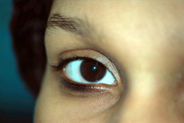 04_04_02-ruthies_eye01.jpg